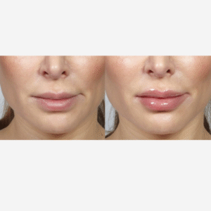 WUNDER2 Wunder Kiss Professional Controlled Lip Plumping, 0.27 Fluid Ounce - Image 8