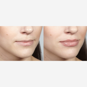 WUNDER2 Wunder Kiss Professional Controlled Lip Plumping, 0.27 Fluid Ounce - Image 5